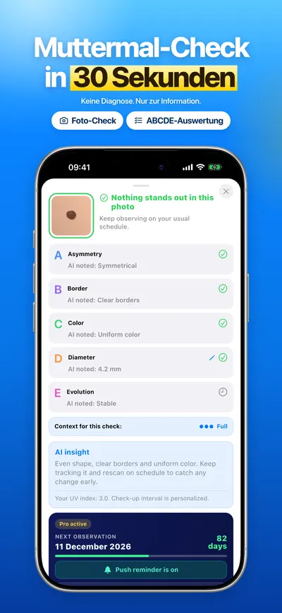 Screenshot der CheckMole-iOS-App