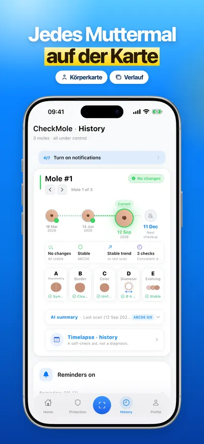 Screenshot der CheckMole-iOS-App