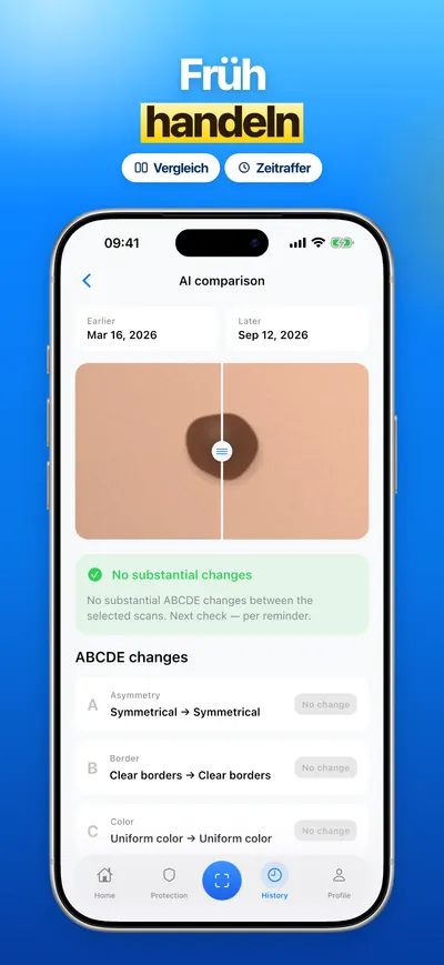 Screenshot der CheckMole-iOS-App