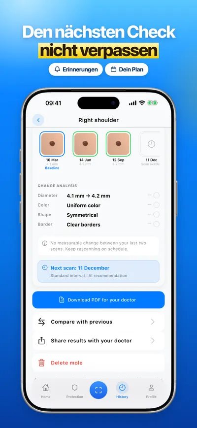 Screenshot der CheckMole-iOS-App
