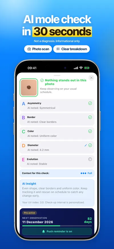 CheckMole iOS app screenshot