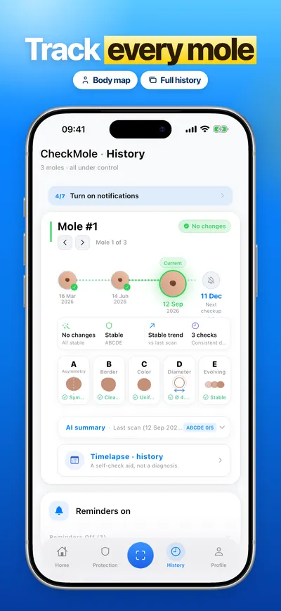 CheckMole iOS app screenshot