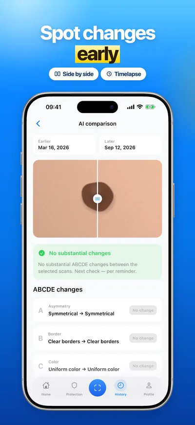 CheckMole iOS app screenshot