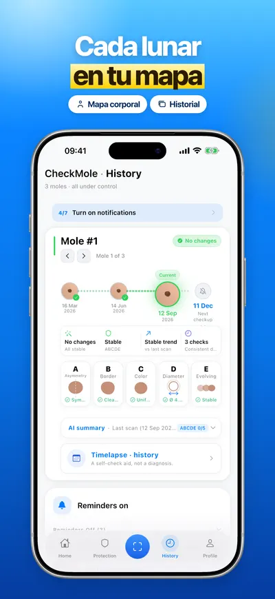 Captura de la app CheckMole para iOS