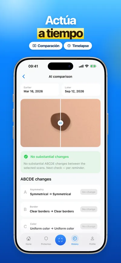 Captura de la app CheckMole para iOS
