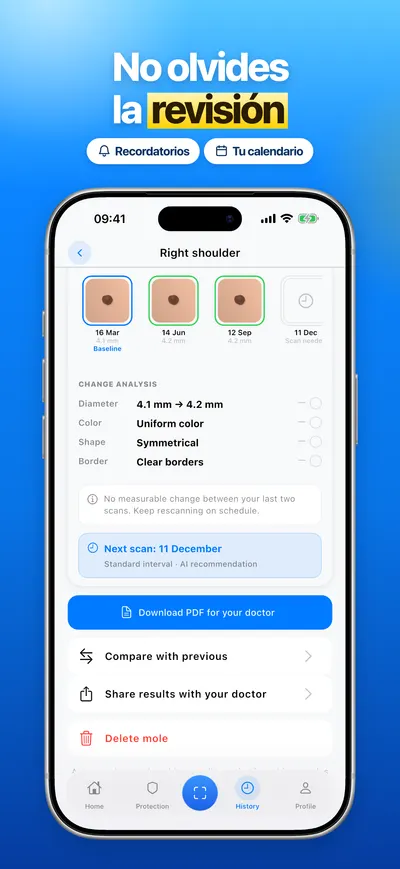 Captura de la app CheckMole para iOS