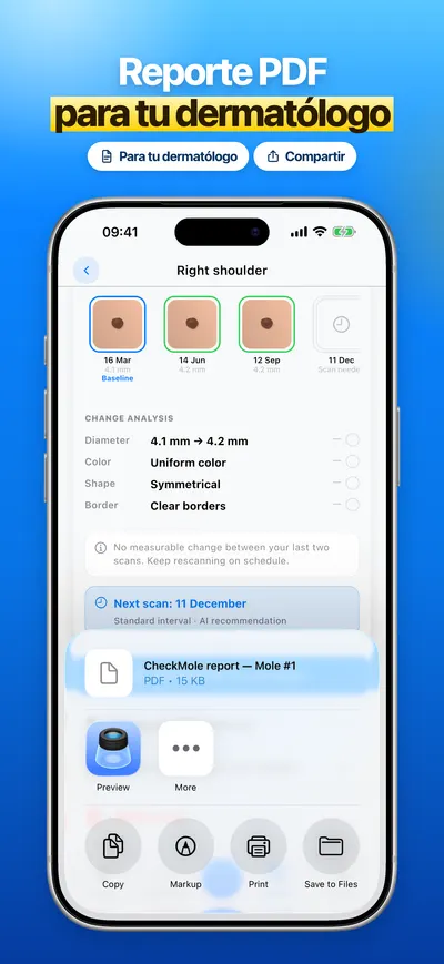 Captura de la app CheckMole para iOS