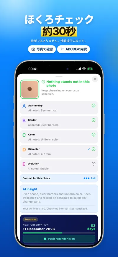 CheckMole iOSアプリのスクリーンショット