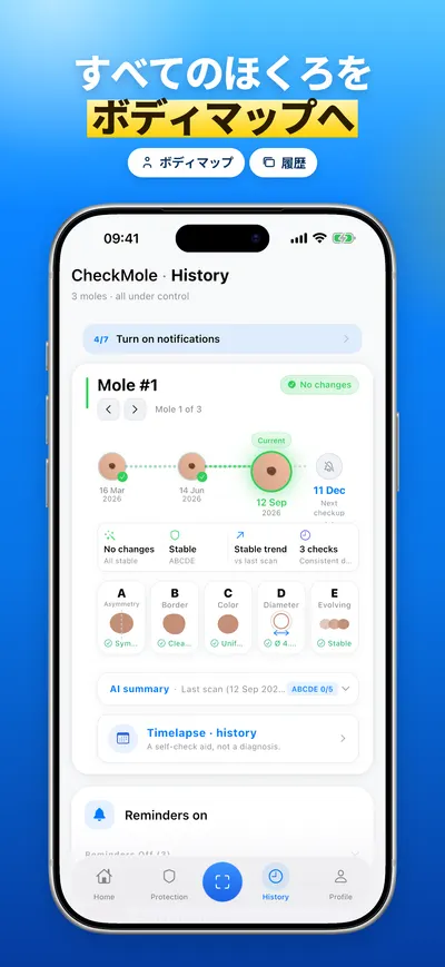 CheckMole iOSアプリのスクリーンショット
