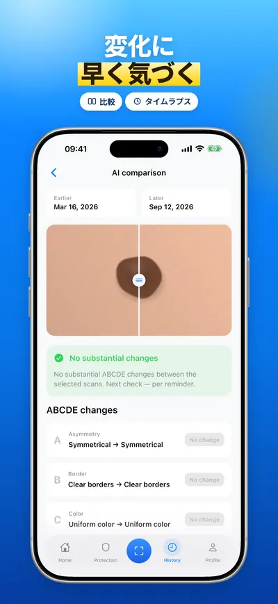 CheckMole iOSアプリのスクリーンショット