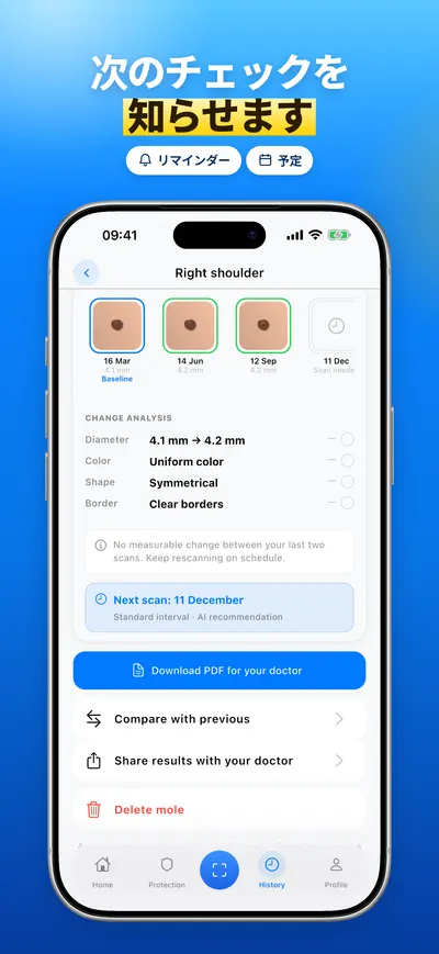 CheckMole iOSアプリのスクリーンショット