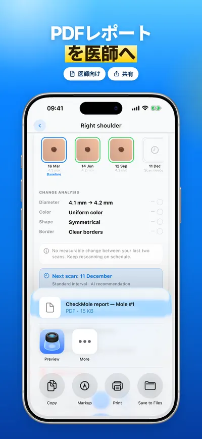 CheckMole iOSアプリのスクリーンショット