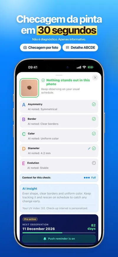 Captura de tela do app CheckMole para iOS