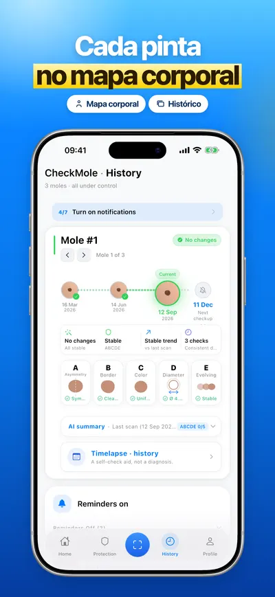 Captura de tela do app CheckMole para iOS