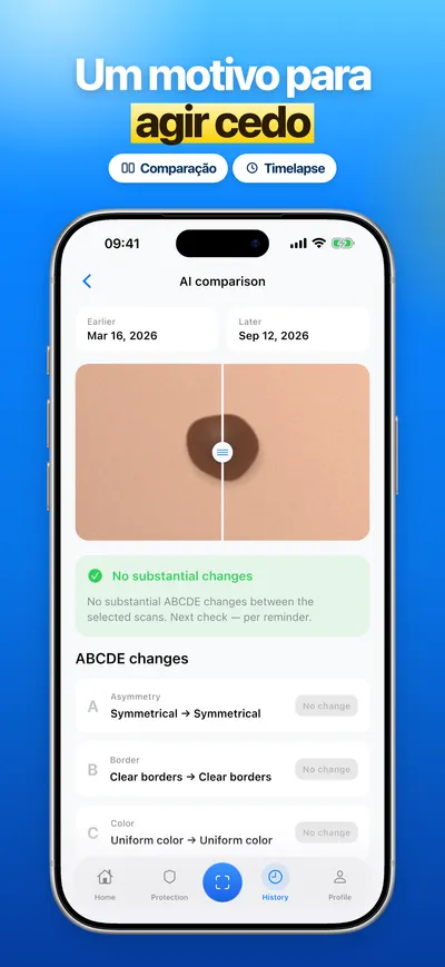 Captura de tela do app CheckMole para iOS