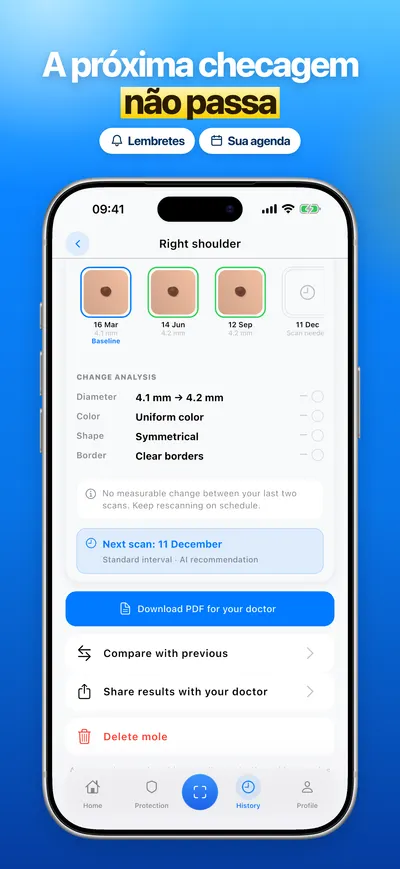Captura de tela do app CheckMole para iOS