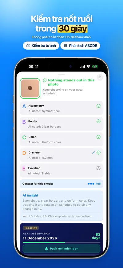 Ảnh chụp màn hình ứng dụng CheckMole trên iOS