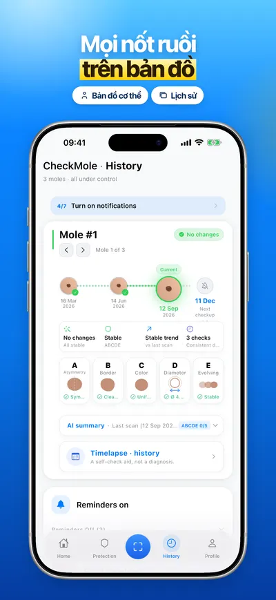 Ảnh chụp màn hình ứng dụng CheckMole trên iOS