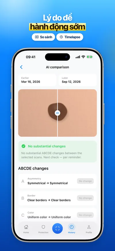 Ảnh chụp màn hình ứng dụng CheckMole trên iOS