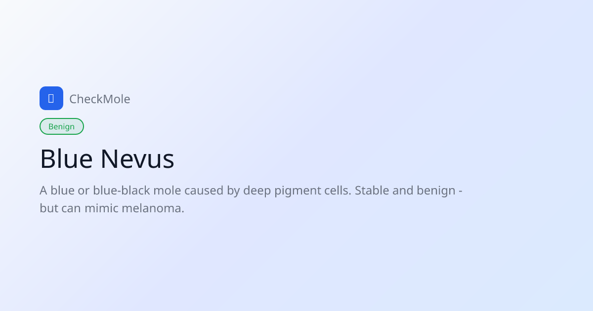 Blue Nevus (Blue Mole): Blue Dot on Skin - Causes & When to Worry ...