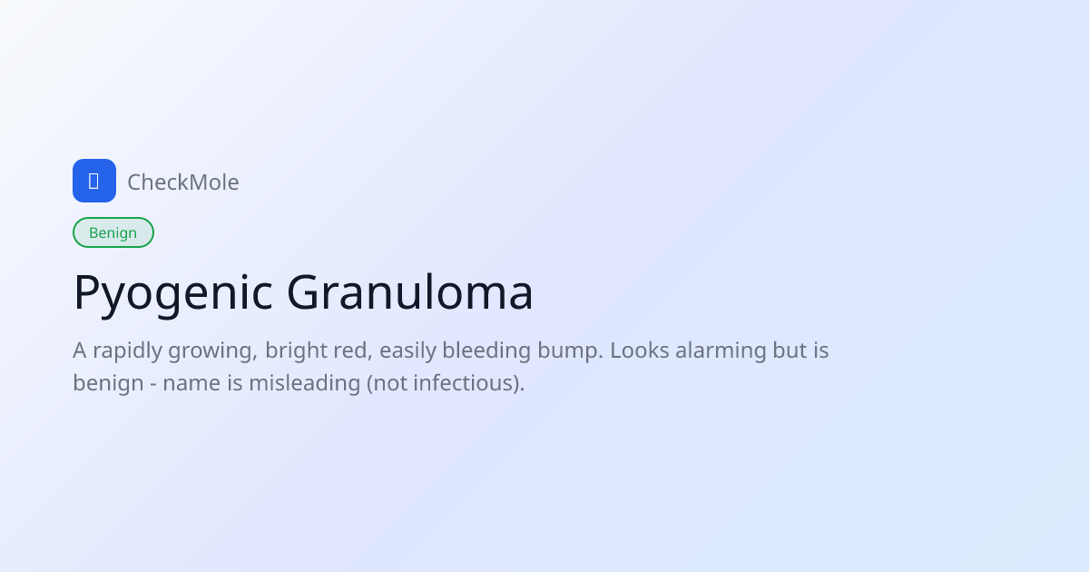Pyogenic Granuloma: Fast-Growing Red Bump That Bleeds - CheckMole