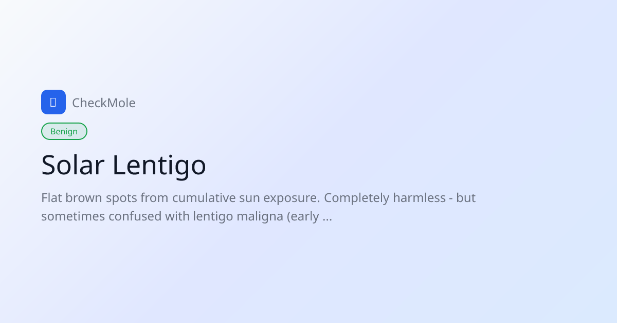 Solar Lentigo (Age Spots): Harmless or Early Melanoma? - CheckMole