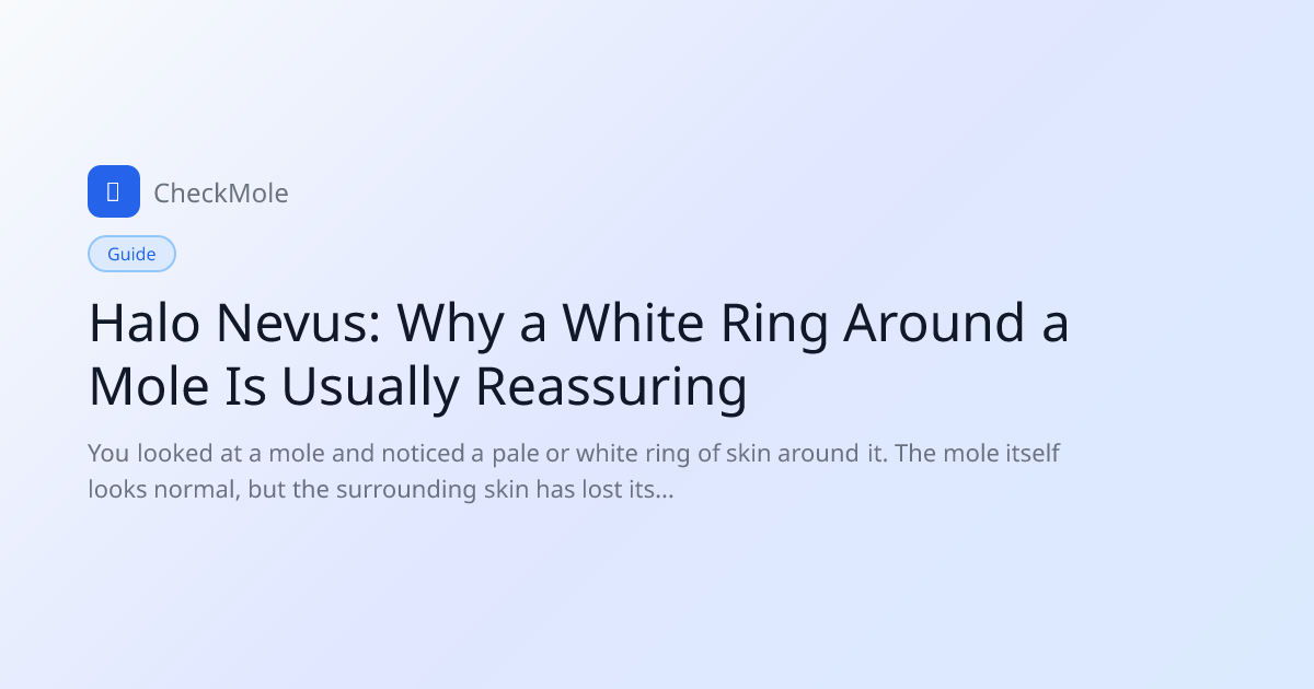 Halo Nevus: White Ring Around Mole — What It Means (2026 Guide) - CheckMole
