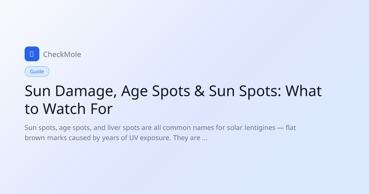 Sun Damage, Age Spots & Sun Spots: Normal Aging or Skin Cancer? (2026 ...